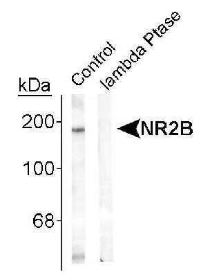 Western Blot: NMDAR2B [p Tyr1336] Antibody [NB300-295]